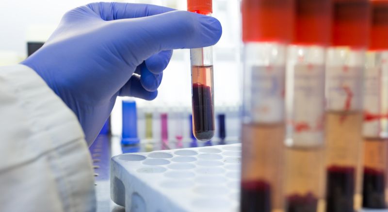 A Veterinarian holding a sample tube of a dog's blood